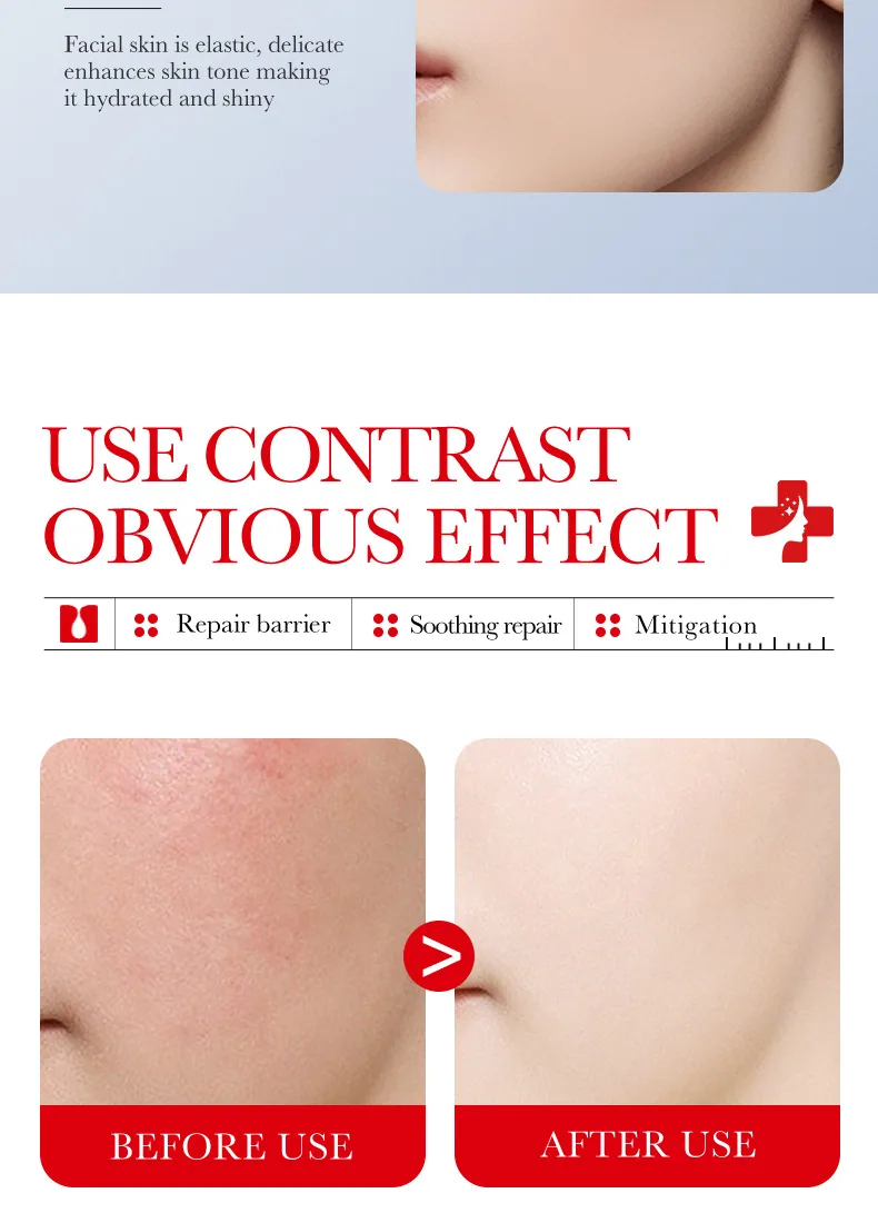 Comparison before and after cross-border wholesale use of SADOER ceramide soothing and repairing face cream sensitive muscle 