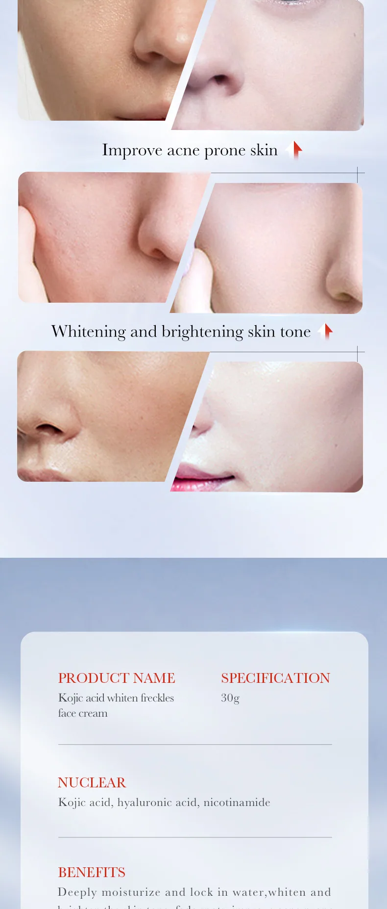 Close up of details of SADOER kojic acid whitening and freckle removing cream, brightening, brightening, lightening and melan