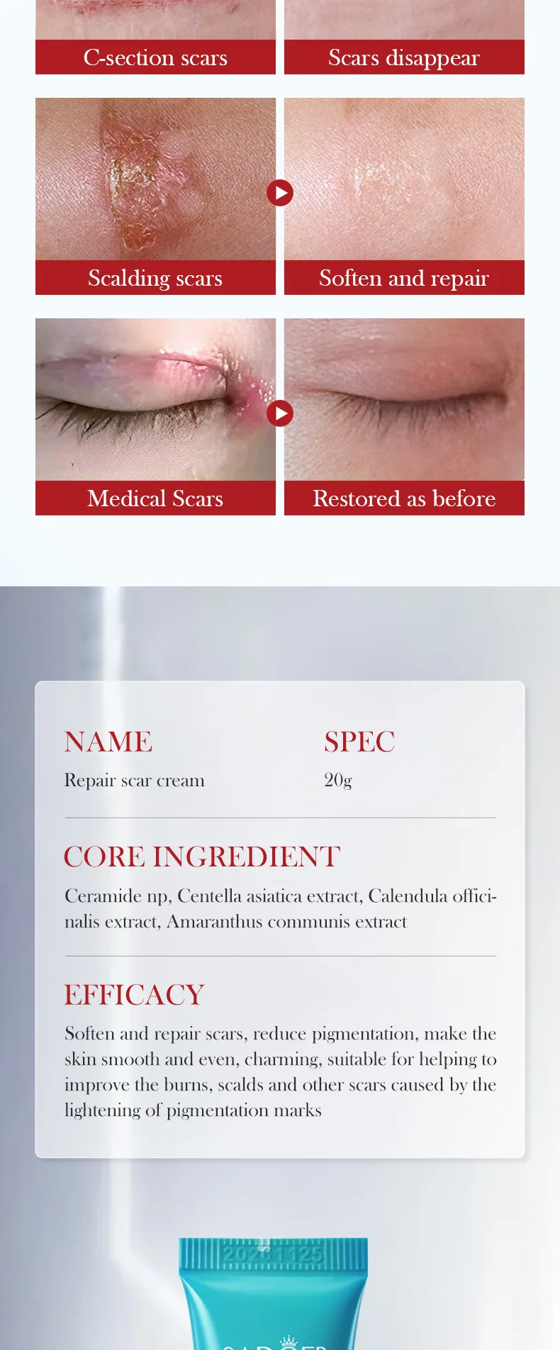 SADOER Scar Repair Cream can be used in multiple scenarios to showcase its ability to moisturize and rejuvenate the face and 