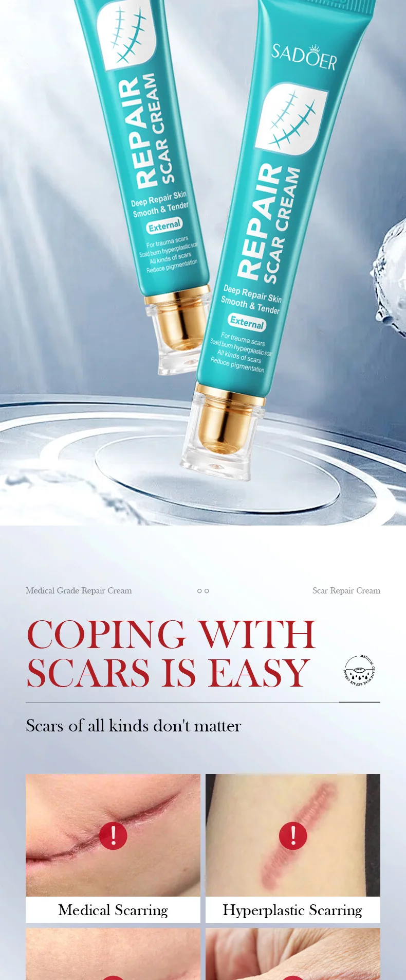 SADOER Scar Repair Cream Before and After Use Comparison Display Moisturizing and Rejuvenating Facial Body Suitable for Forei
