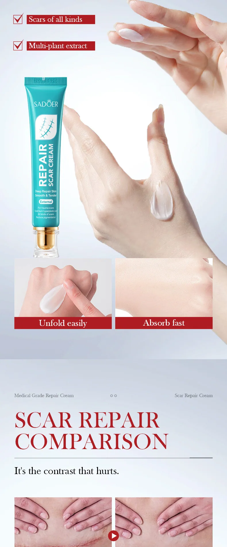 SADOER Scar Repair Cream Body Application Display Moisturizing and Stretching Facial and Body Care Cross border Wholesale