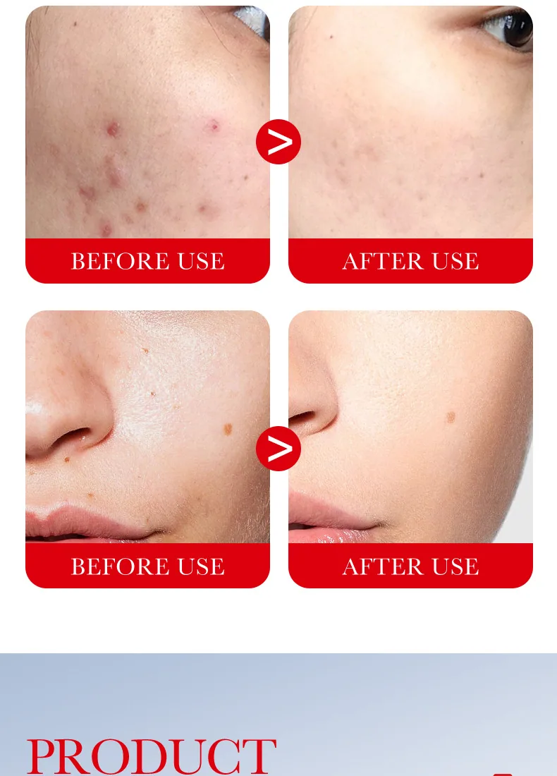 SADOER Ceramide Soothing and Repairing Cream for Foreign Trade - Moisturizing and Moisturizing Sensitive Skin -18th Qualitati