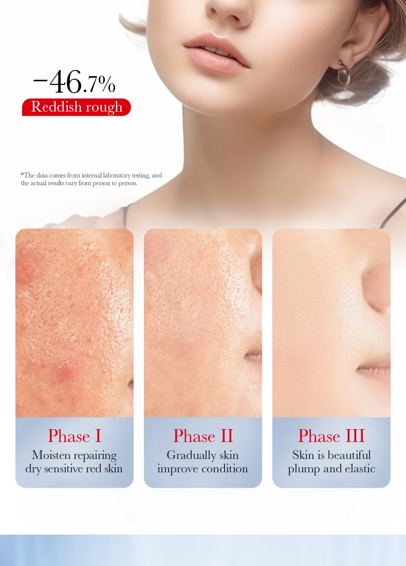 Foreign Trade SADOER Ceramide Soothing Repair Cream Sensitive Skin Moisturizing face cream Page 11 Packaging Details Wholesal
