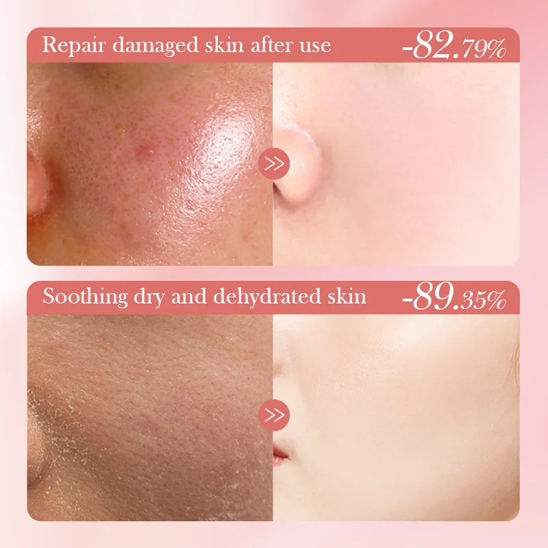 SADOER Peach Lactobacillus Soothing and Moisturizing lotion Facial and Body facial mask Details, cross-border supply of moist