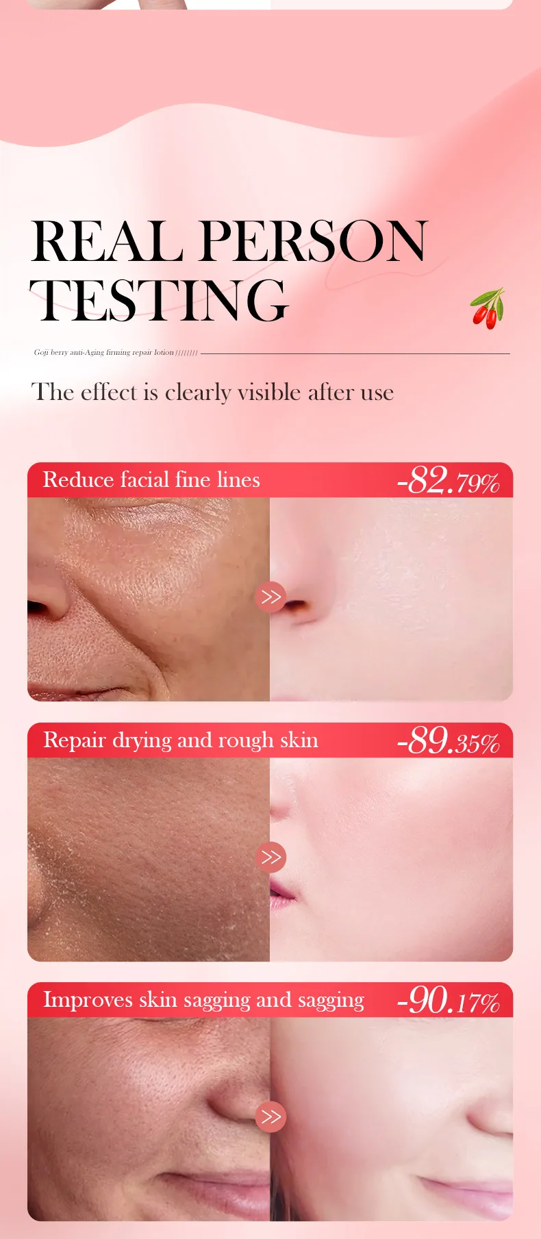 SADOER Lycium Buckle Anti wrinkle Firming Repair lotion Absorption Effect Comparison Moisture Replenishment Wholesale Foreign