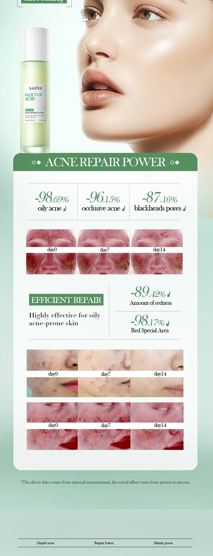 Close up of SADOER Salicylic Acid essence with refreshing texture, moisturizing and repairing acne skin care scene