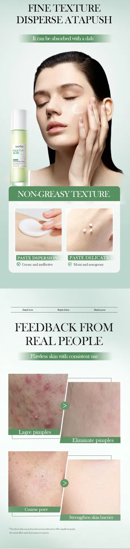 SADOER Salicylic Acid Acne Removing essence Ingredient Selling Point Diagram, Repair Moisturizing Refreshing Lotion Cross bor