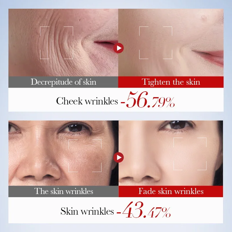 SADOER Snail Collagen facial mask can be selected in many styles to display the color difference of firming, anti wrinkle and
