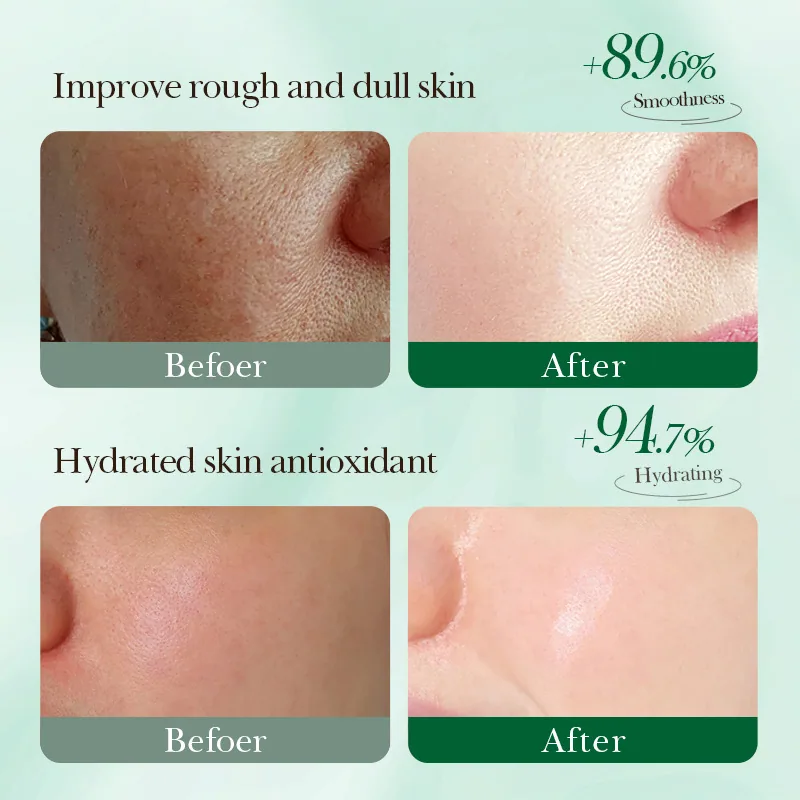 SADOER Aloe Repair and Revitalizing Freeze-Dried Powder usage scenario image, sensitive skin facial care paired with body mas