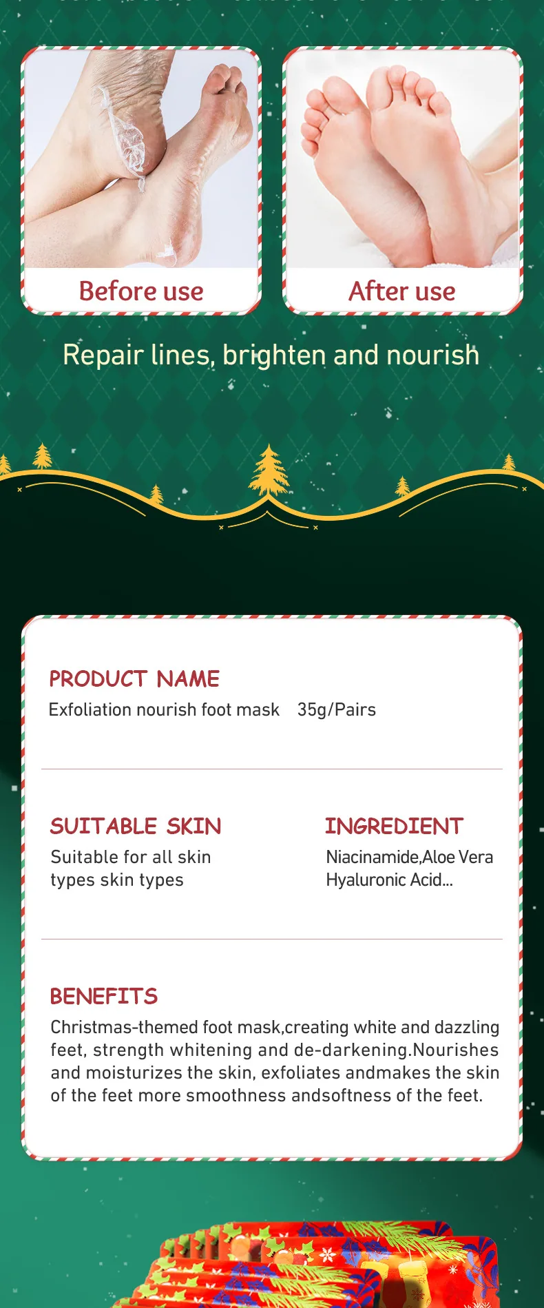 Ayak maskesi SADOER Noel niasinamid besleyici peeling ayak maskesi Ayak filmi Sınır ötesi cilt bakımı 14