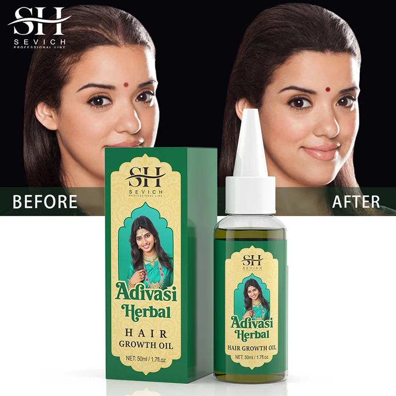Minyak rambut Herbal Adivasi 4
