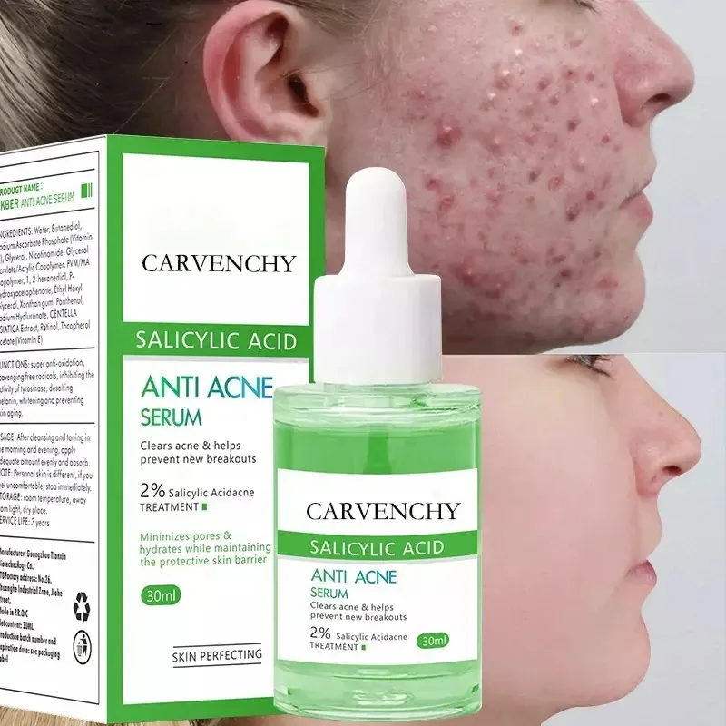 Grenzüberschreitendes exklusives ANTI ACNE SERUM Akne klärende, beruhigende, feuchtigkeitsspendende, straffende Akne-Serum-Essenz 11