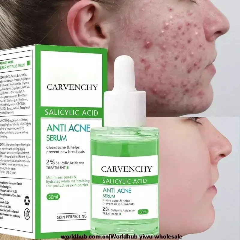 Grenzüberschreitendes exklusives ANTI ACNE SERUM Akne klärende, beruhigende, feuchtigkeitsspendende, straffende Akne-Serum-Es