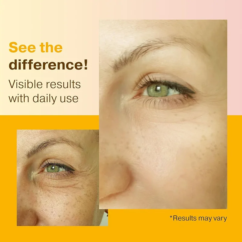 Cross-border exclusive Vitamin C Facial Serum hydrates and moisturizes and stays up late to repair 2