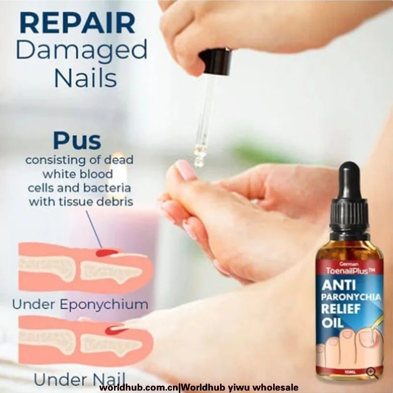 ToenailPlus Anti-Nail Groove Relief Oil Soft Nail Shine Nail Repair Ingrown Nail Thickening Nail Groove Care Oil