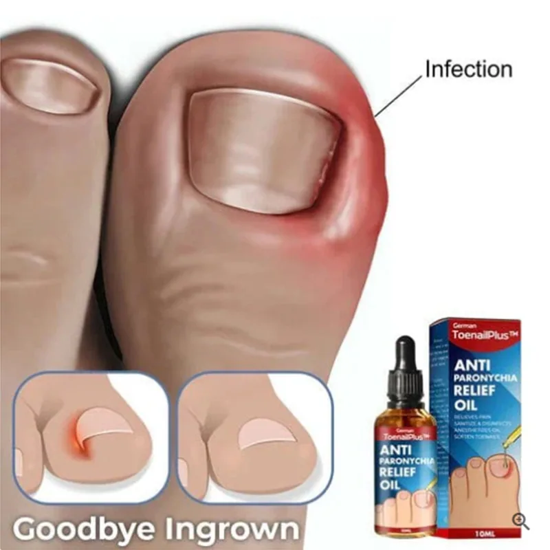 ToenailPlus Anti-Nail Groove Relief Oil Soft Nail Shine Nail Repair Ingrown Nail Thickening Nail Groove Care Oil 3
