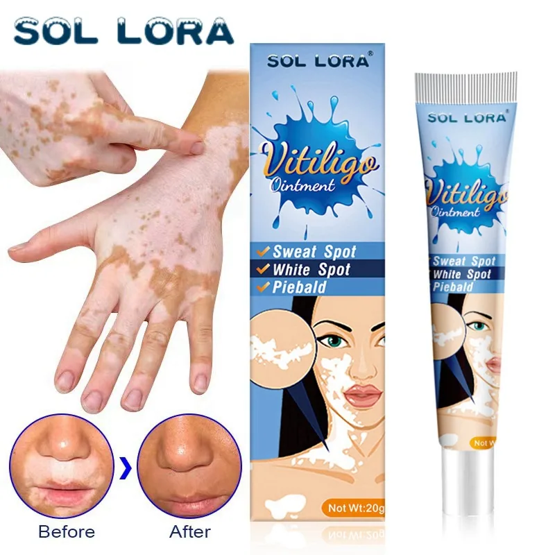 SOL LORA Cross-border Pieplaque Care Health Balm White Spot Cleansing Ointment Spot Sweat Spot Vitiligo Skin Topical Cream 8