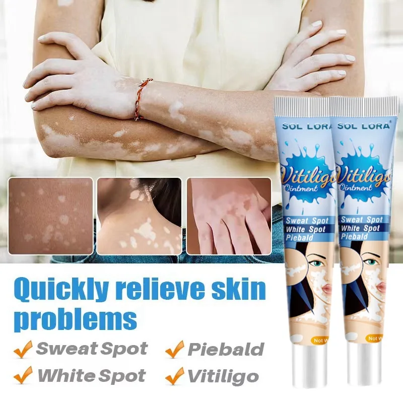 SOL LORA Cross-border Pieplaque Care Health Balm White Spot Cleansing Ointment Spot Sweat Spot Vitiligo Skin Topical Cream 5