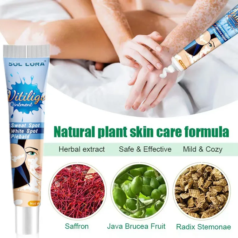 SOL LORA Cross-border Pieplaque Care Health Balm White Spot Cleansing Ointment Spot Sweat Spot Vitiligo Skin Topical Cream 14