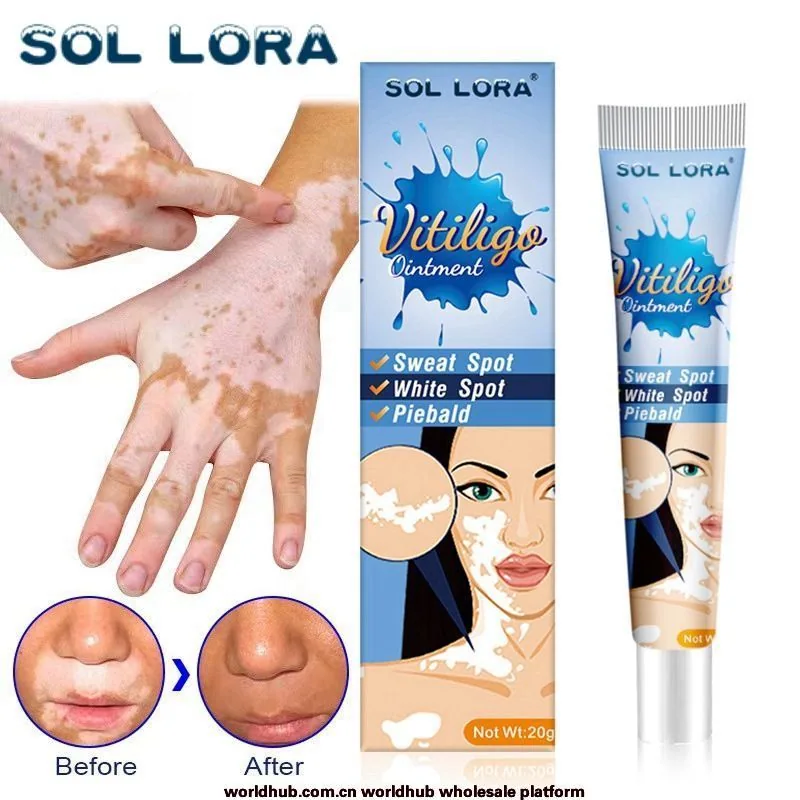 SOL LORA Cross-border Pieplaque Care Health Balm White Spot Cleansing Ointment Spot Sweat Spot Vitiligo Skin Topical Cream