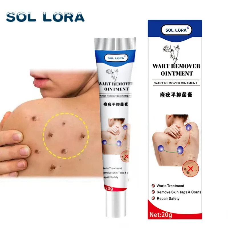 SOL LORA Cross-border Amazon AliExpress Wart Removal Cream Wart Flat Wart Removal Filament Wart Cream Corn Eye Mole Cream 2