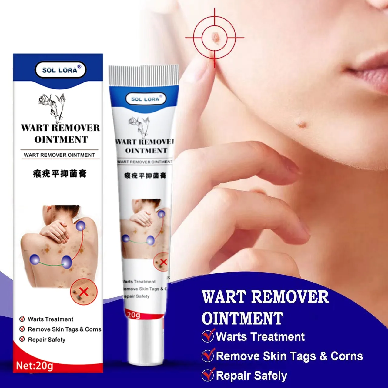 SOL LORA Cross-border Amazon AliExpress Wart Removal Cream Wart Flat Wart Removal Filament Wart Cream Corn Eye Mole Cream 5
