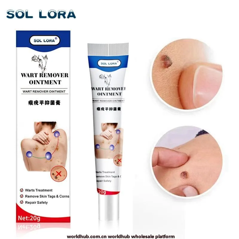 SOL LORA Cross-border Amazon AliExpress Wart Removal Cream Wart Flat Wart Removal Filament Wart Cream Corn Eye Mole Cream