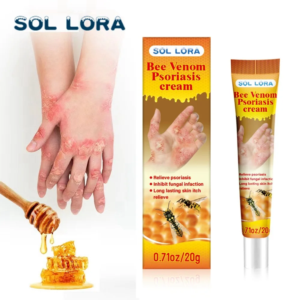 SOL LORA cross-border Amazon explosive bee venom relieves skin itching and repairs hand and foot moss skin repair cream 5