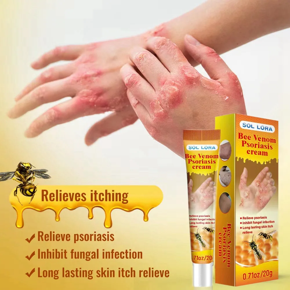 SOL LORA cross-border Amazon explosive bee venom relieves skin itching and repairs hand and foot moss skin repair cream 6