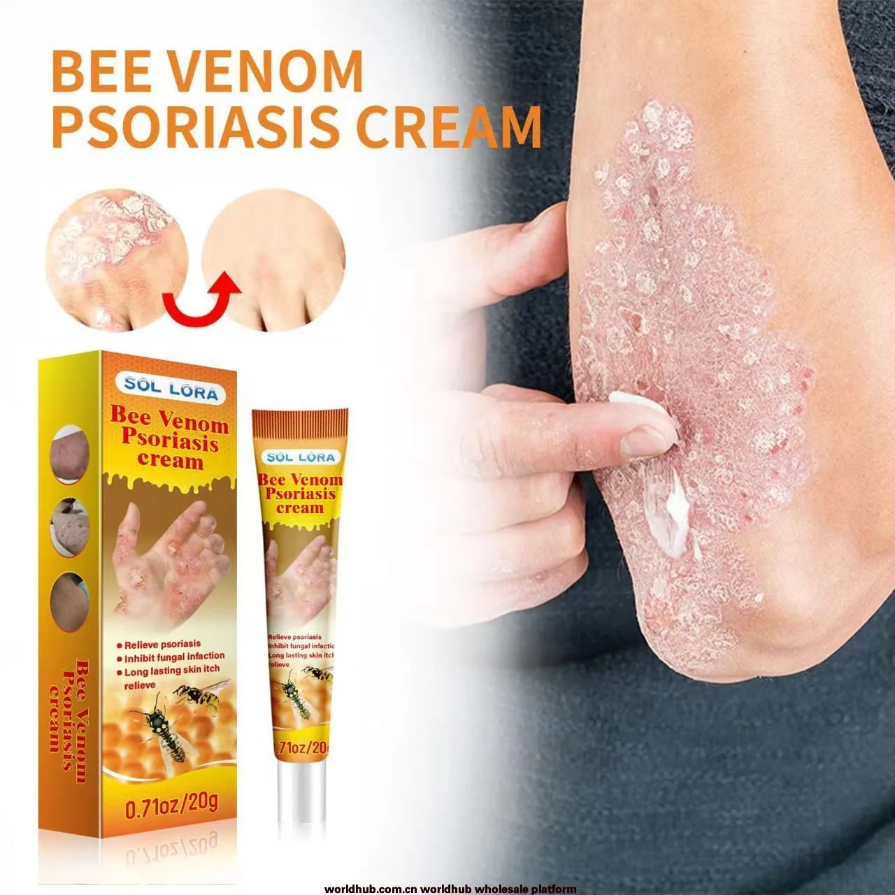 SOL LORA cross-border Amazon explosive bee venom relieves skin itching and repairs hand and foot moss skin repair cream 2