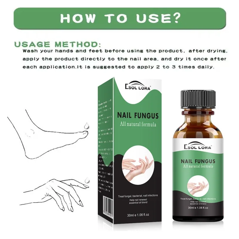 SOL LORA AliExpress Amazon Nail Repair Liquid Moisturizing Barb Brightening Nail Polish Soft Nail Keratin Finger Edge Oil 8