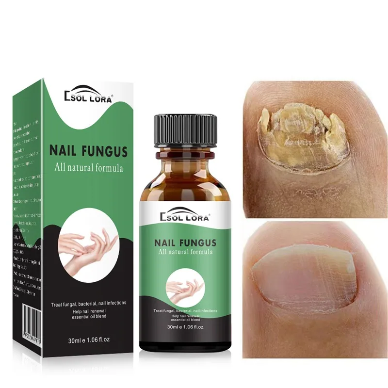 SOL LORA AliExpress Amazon Nail Repair Liquid Moisturizing Barb Brightening Nail Polish Soft Nail Keratin Finger Edge Oil 5