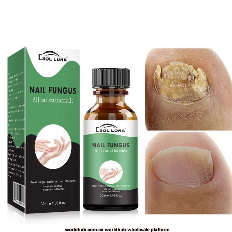 SOL LORA AliExpress Amazon Nail Repair Liquid Moisturizing Barb Brightening Nail Polish Soft Nail Keratin Finger Edge Oil