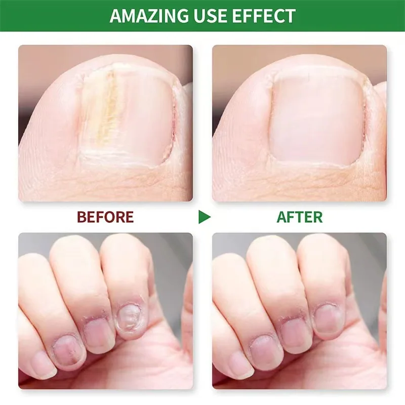 SOL LORA AliExpress Amazon Nail Repair Liquid Moisturizing Barb Brightening Nail Polish Soft Nail Keratin Finger Edge Oil 4