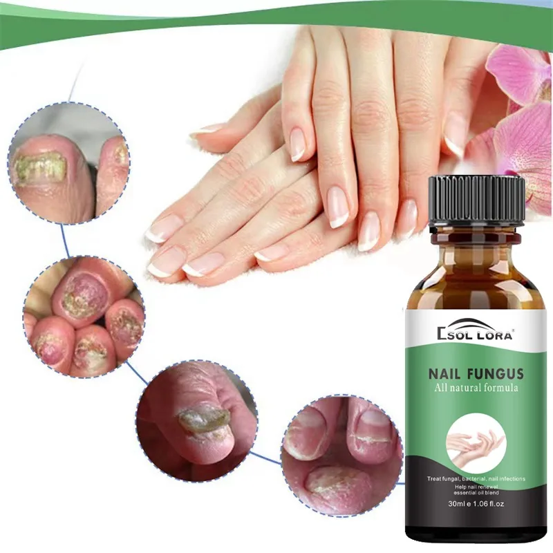 SOL LORA AliExpress Amazon Nail Repair Liquid Moisturizing Barb Brightening Nail Polish Soft Nail Keratin Finger Edge Oil 6