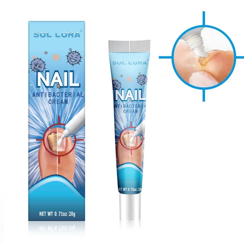 SOL LORA Amazon temuWish AliExpress 20g Nail Cream Nail Fungus Soft Nail Removal Ointment 2