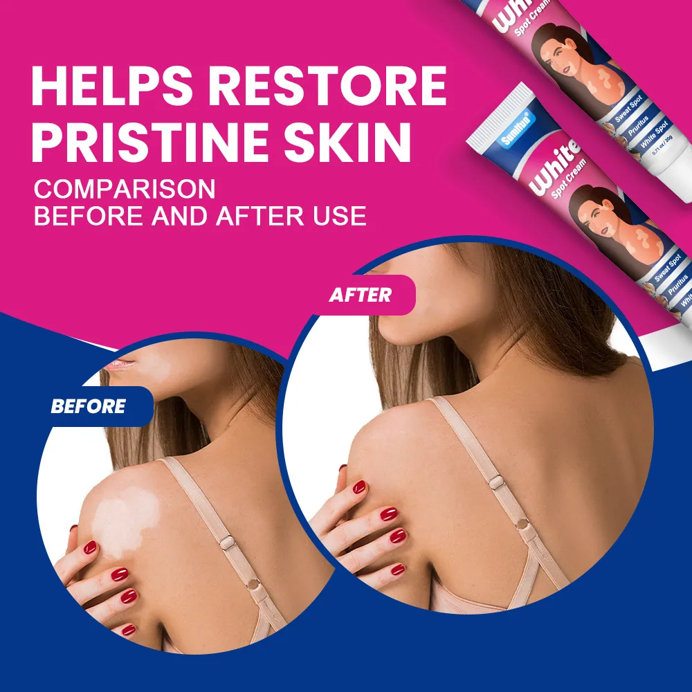 sumifun White Spot Cream Skin Care Cream Amazon Wildberries AliExpress TK Cross Border K10209 16