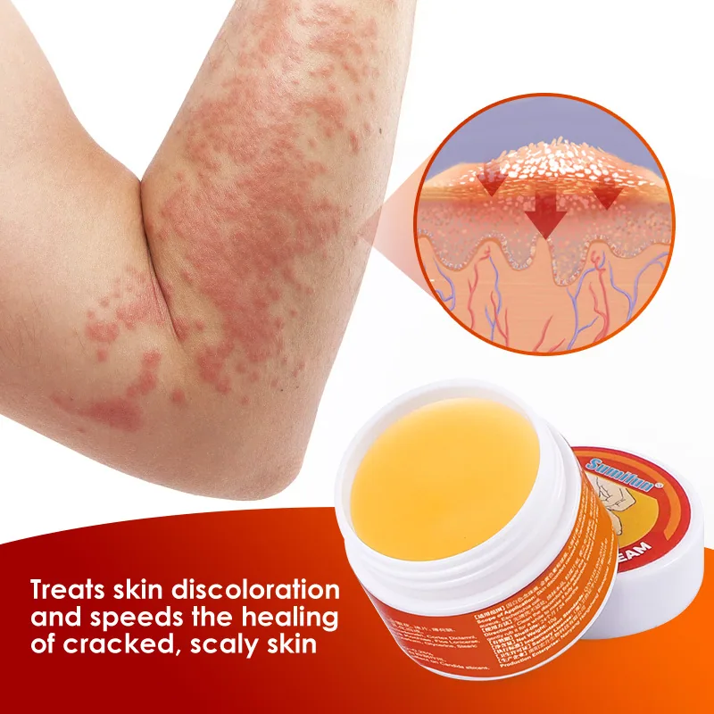 Sumifun Foreign Trade Cross Border Amazon 10g Dermatitis Eczema Itch Psoriasis Anti-Itch Plaster K20014 10