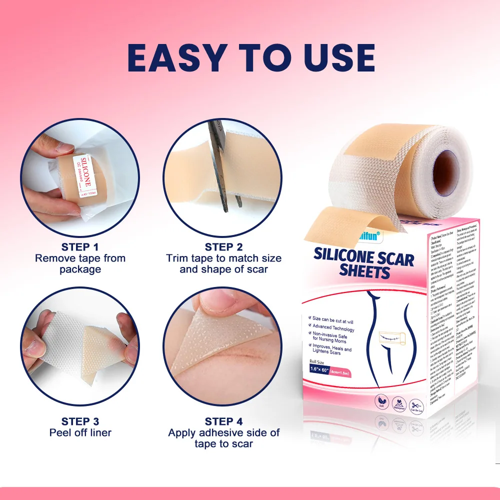 پچ ترمیم کننده اسکار ژل سیلیکونی Sumifun Patch مکانیکی Scar Scar Skin Scar Repair Scar Scar K000013 4