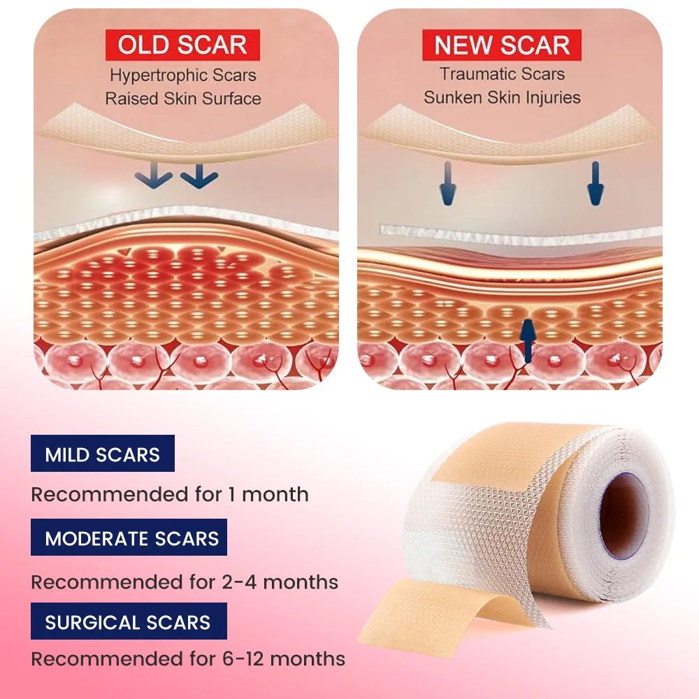 پچ ترمیم کننده اسکار ژل سیلیکونی Sumifun Patch مکانیکی Scar Scar Skin Scar Repair Scar Scar K000013 17