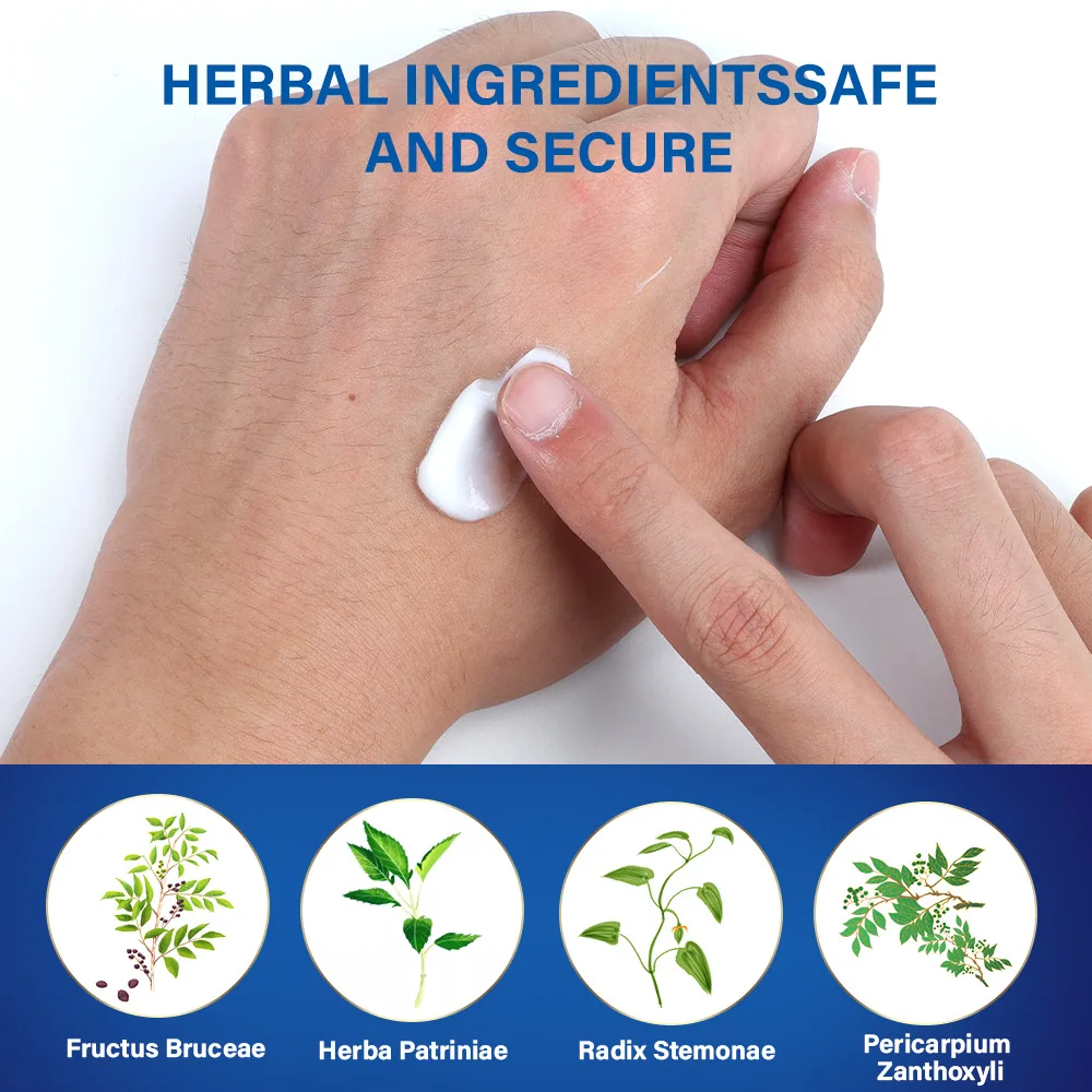 Sumifun foot wart removal cream cross-border explosive Russian foreign trade spot foot warts corn eye wart flat K10149 15