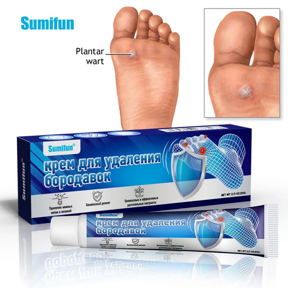 Sumifun foot wart removal cream cross-border explosive Russian foreign trade spot foot warts corn eye wart flat K10149 10