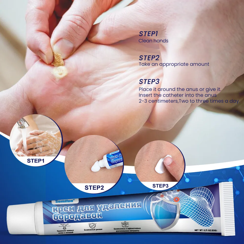 Sumifun foot wart removal cream cross-border explosive Russian foreign trade spot foot warts corn eye wart flat K10149 4