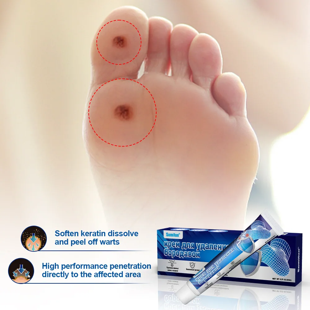 Sumifun foot wart removal cream cross-border explosive Russian foreign trade spot foot warts corn eye wart flat K10149 11
