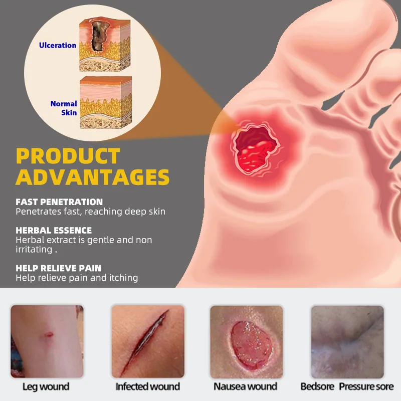 sumifun AliExpress Amazon temu cross-border pressure ulcer cream pressure ulcer care elderly health K10110 7