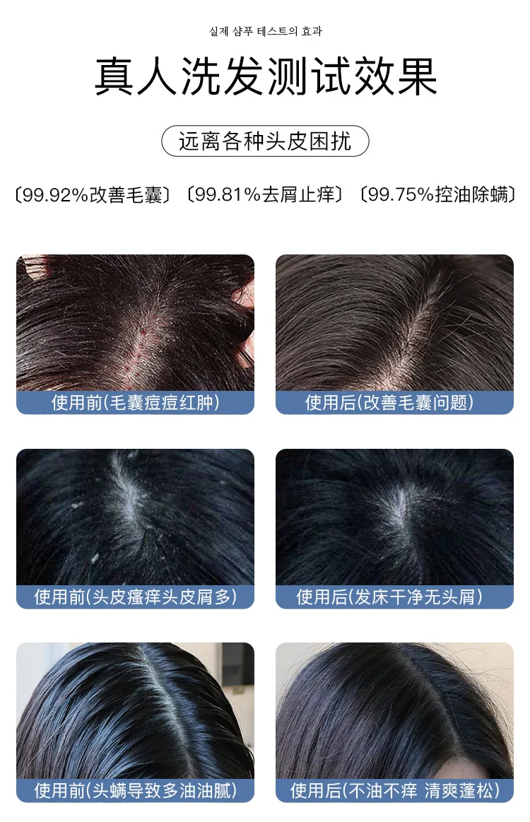 Nanjing Tongrentang Kailan Duo amino acid scalp cleansing shampoo lotion wholesale hair inflammation repair Ning plant mite remo 13