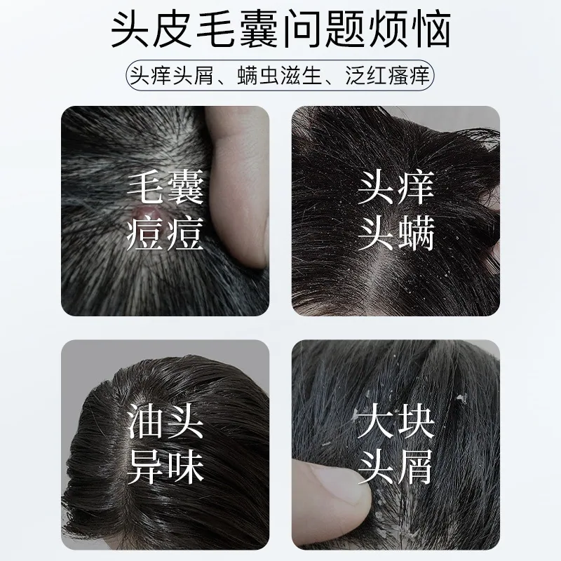 Nanjing Tongrentang Kailan Duo amino acid scalp cleansing shampoo lotion wholesale hair inflammation repair Ning plant mite remo 4