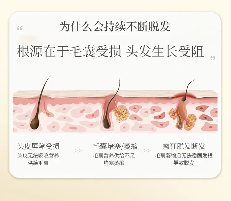 Douyin same popular anti-hair loss shampoo hair growth shampoo ginger plant extract shampoo wholesale 8