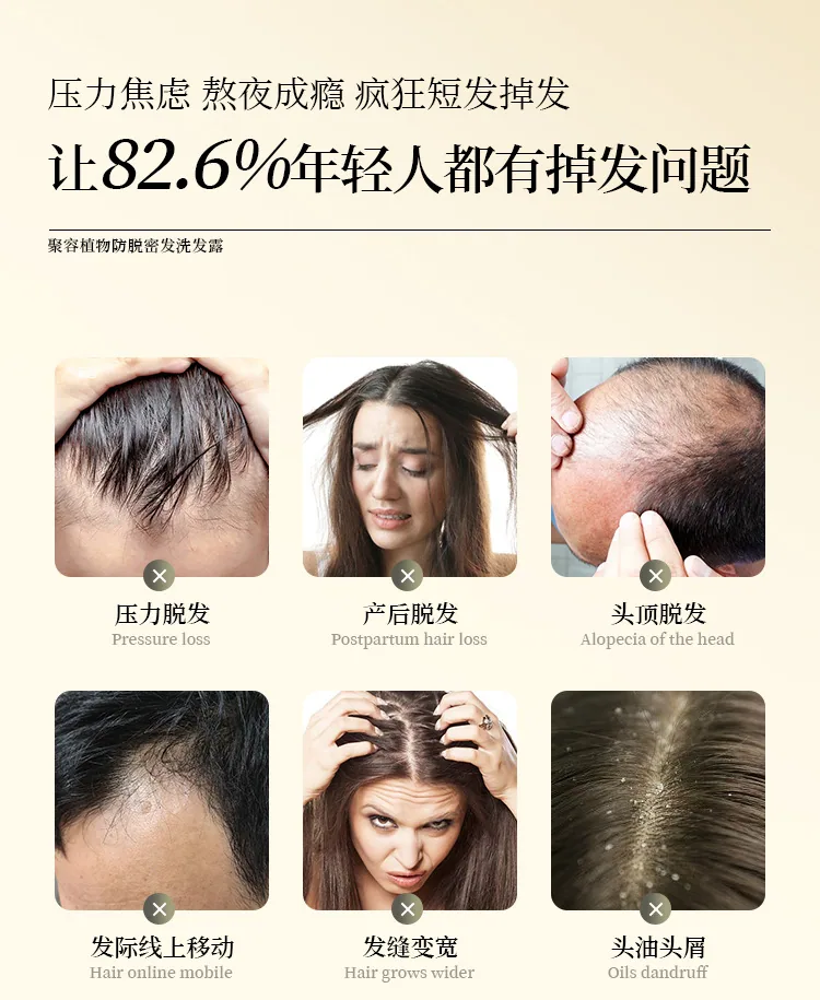 Douyin same popular anti-hair loss shampoo hair growth shampoo ginger plant extract shampoo wholesale 9