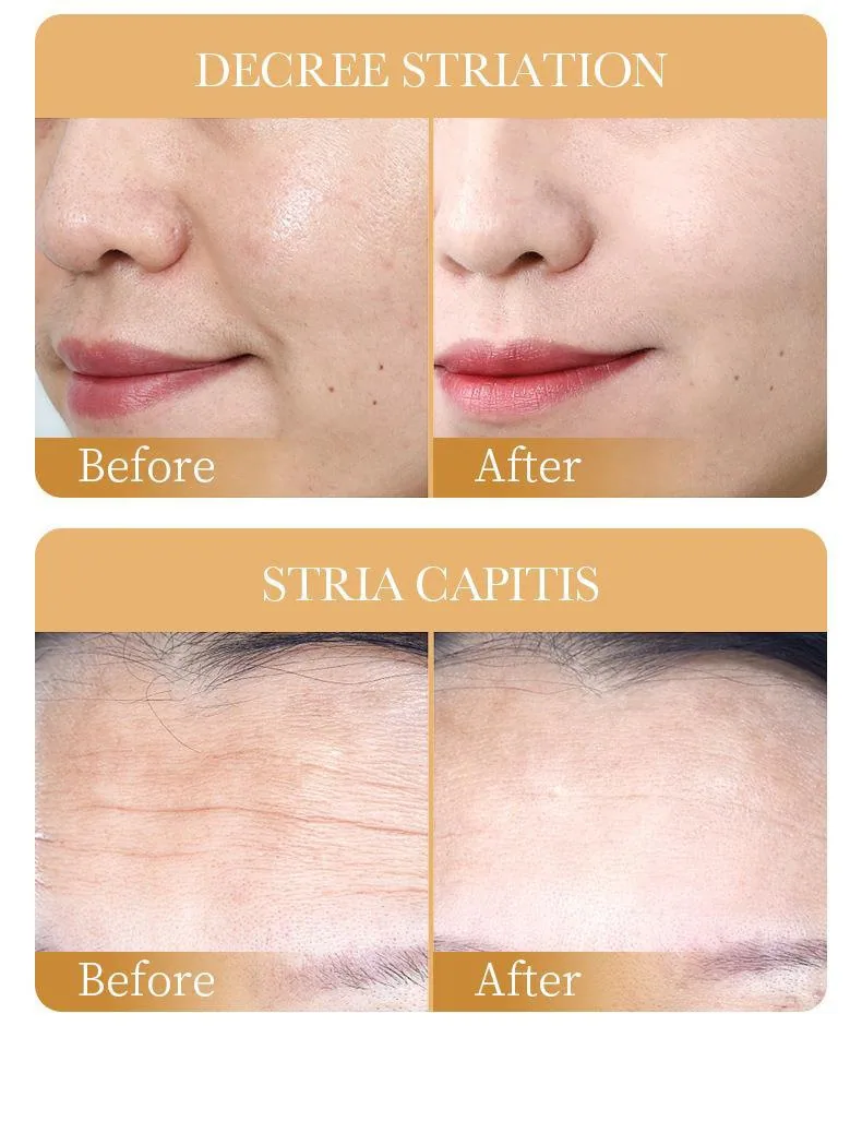 SADOER collagen anti-wrinkle facial mask sheet close-up showing moisturizing brightening essence texture for cross-border for